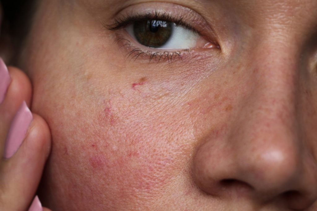 sensitive skin skincare