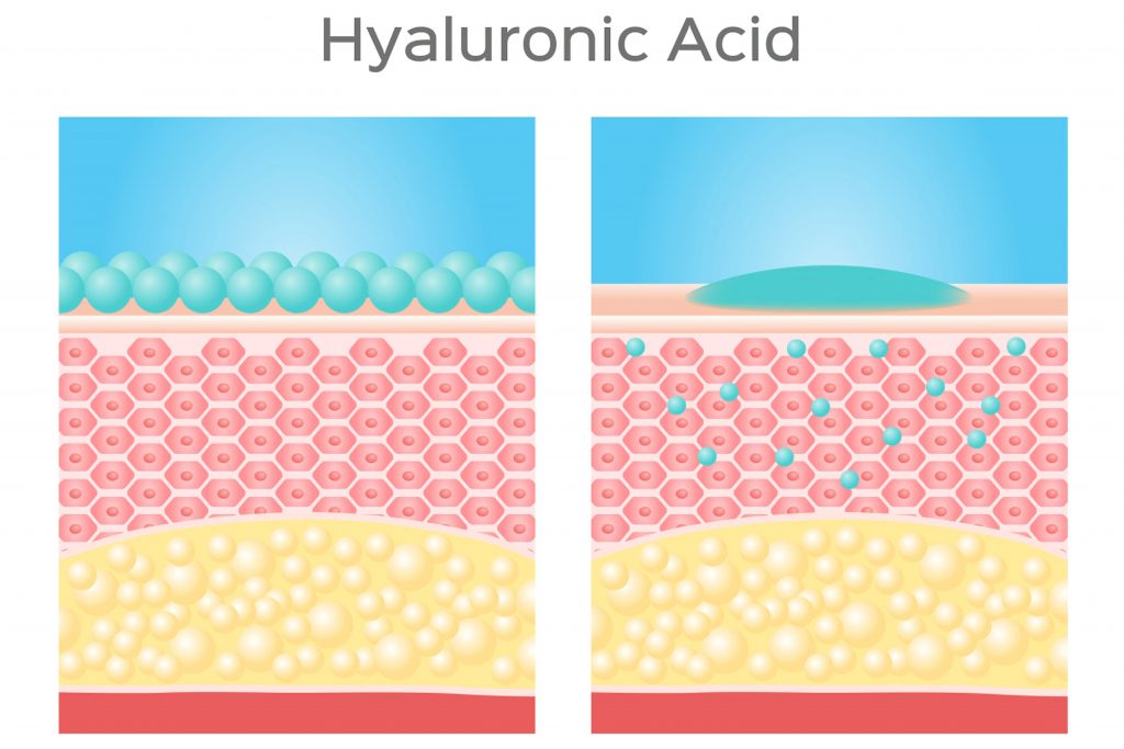 Hyaluronic acid benefits